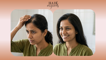 I Had Thinning Hair and I Found the Answer: Here's What Actually Works in 2026