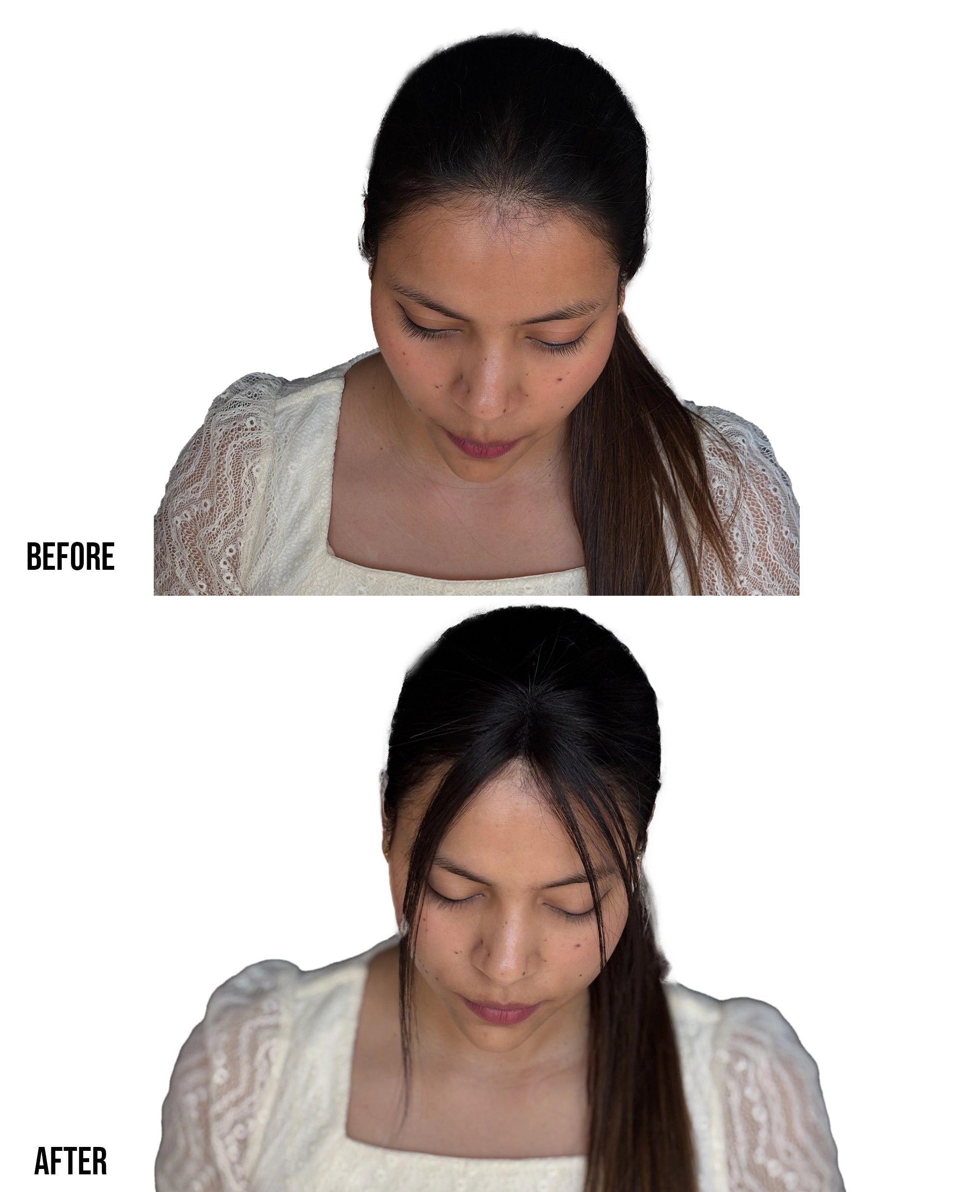 Front Hair Thinning Cover Up Patch | 2.5x1.5 | Natural Hairline & Forehead Coverage Patch Hair Extensions HairOriginals