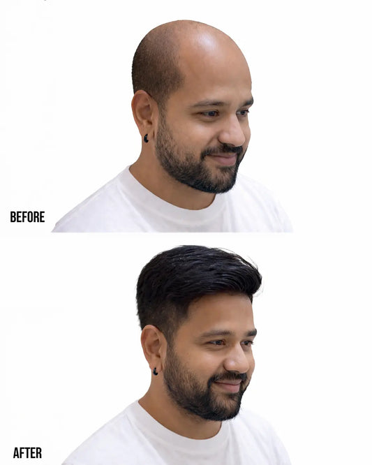 Men Patch - Premium Silk Mirage | Celebrity Patch Hair Extensions HairOriginals 8*6 Natural Black