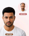 Men Patches | 100% Human Hair