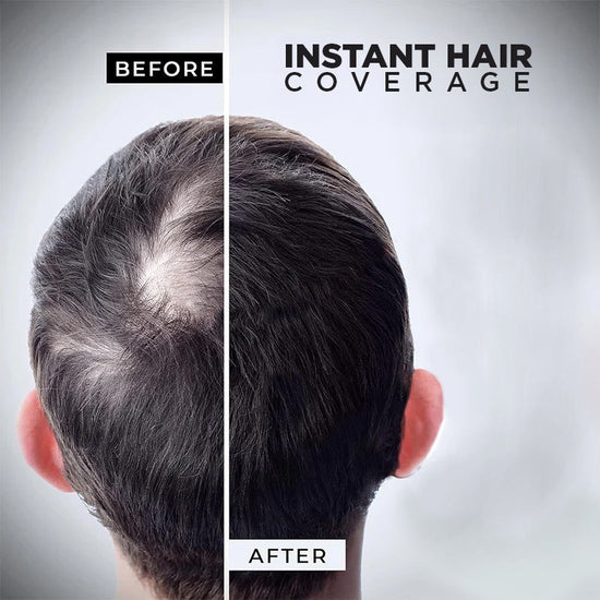 Hair Fiber | Transform Thin, And Fine Hair With Hair Building Fiber | Hair Volumizing Fibers For Women & Men Hair Fiber HairOriginals