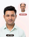 Men Patch - Mono Hair Extensions HairOriginals