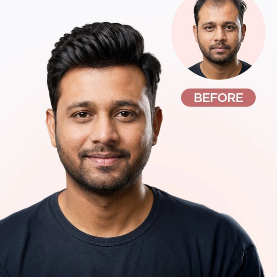 Men Patch - Mirage Hair Extensions HairOriginals