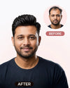 Men Patch - Mirage Hair Extensions HairOriginals