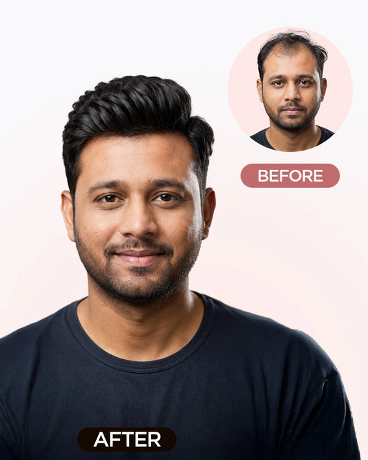 Men Patch - Mirage Hair Extensions HairOriginals