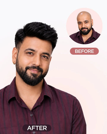 Los Angeles Men Patch Hair Extensions HairOriginals