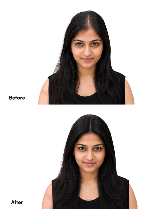 Premium Silk Scalp Topper | 6x5 | 100% Human Hair Extensions | Lightweight & Breathable Hair Extensions HairOriginals